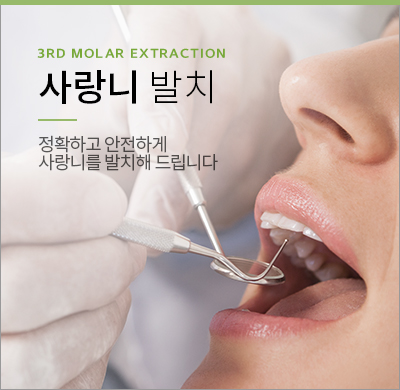 사랑니발치